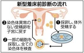 着床前診断